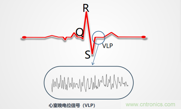解決心電監(jiān)測行業(yè)難題，曼森伯格的濾波技術(shù)獲國家知識產(chǎn)權(quán)局發(fā)明授權(quán)