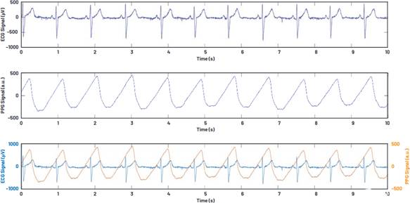 單芯片生物醫(yī)學(xué)模擬前端系列用于可穿戴市場(chǎng) 單芯片生物醫(yī)學(xué)模擬前端系列用于可穿戴市場(chǎng)